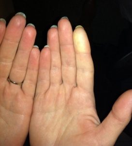 blue finger from Raynadu's