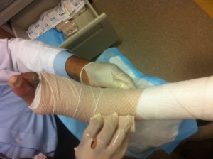 Unna boot compression