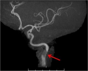 Carotid artery imaging